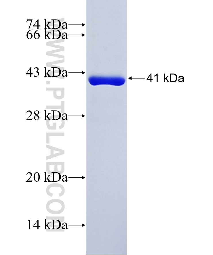 SUMO tag fusion protein Ag26104 SDS-PAGE