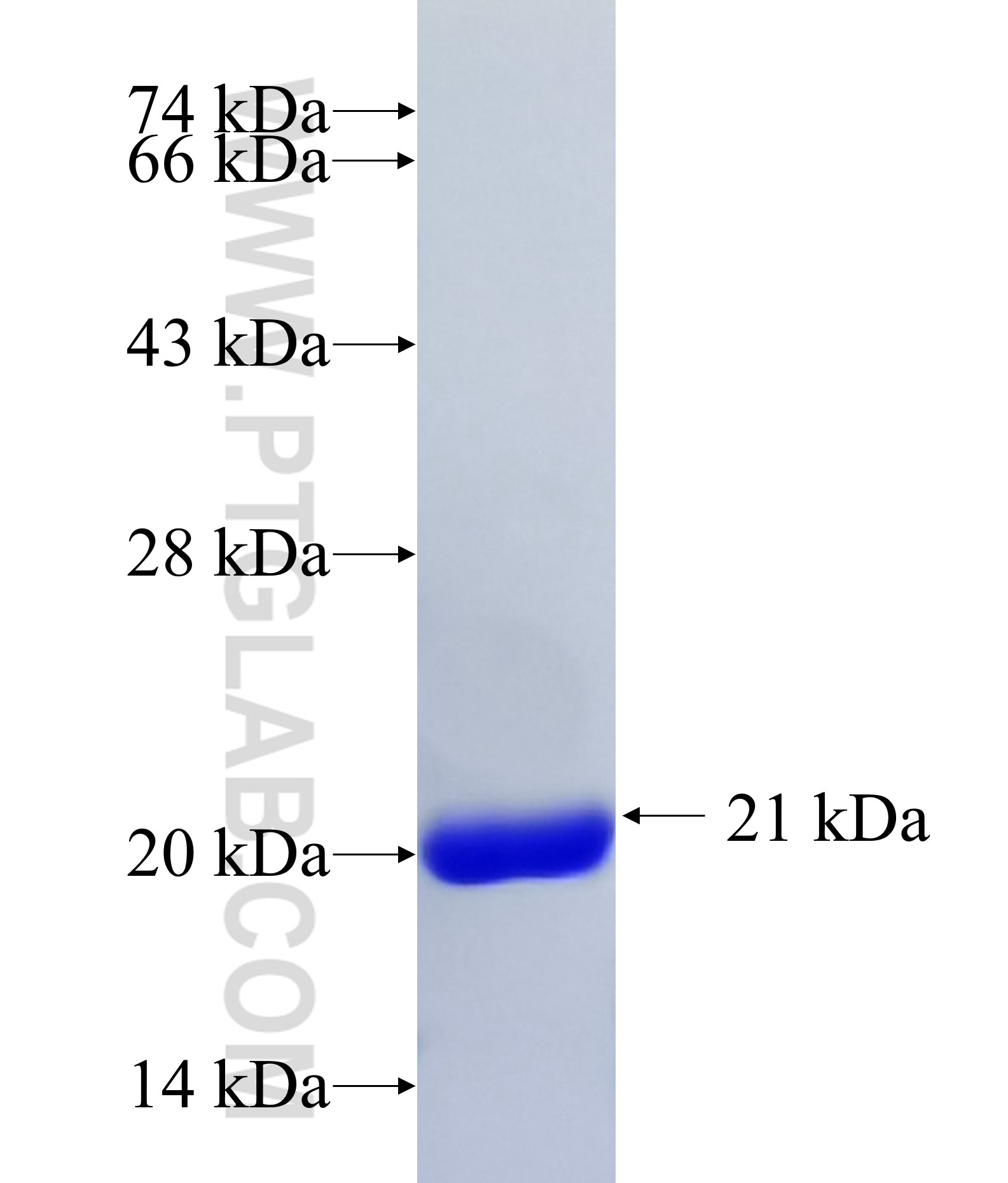 SUMO tag fusion protein Ag26117 SDS-PAGE