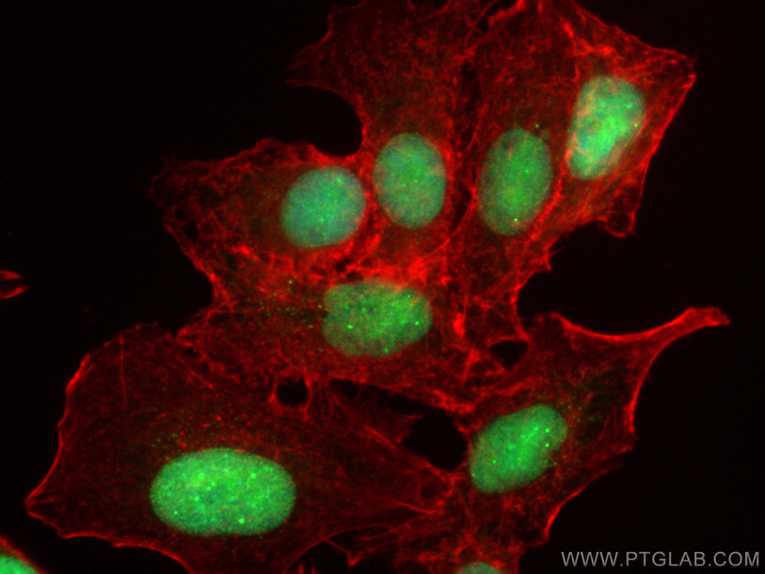 IF Staining of A549 using 10329-1-AP