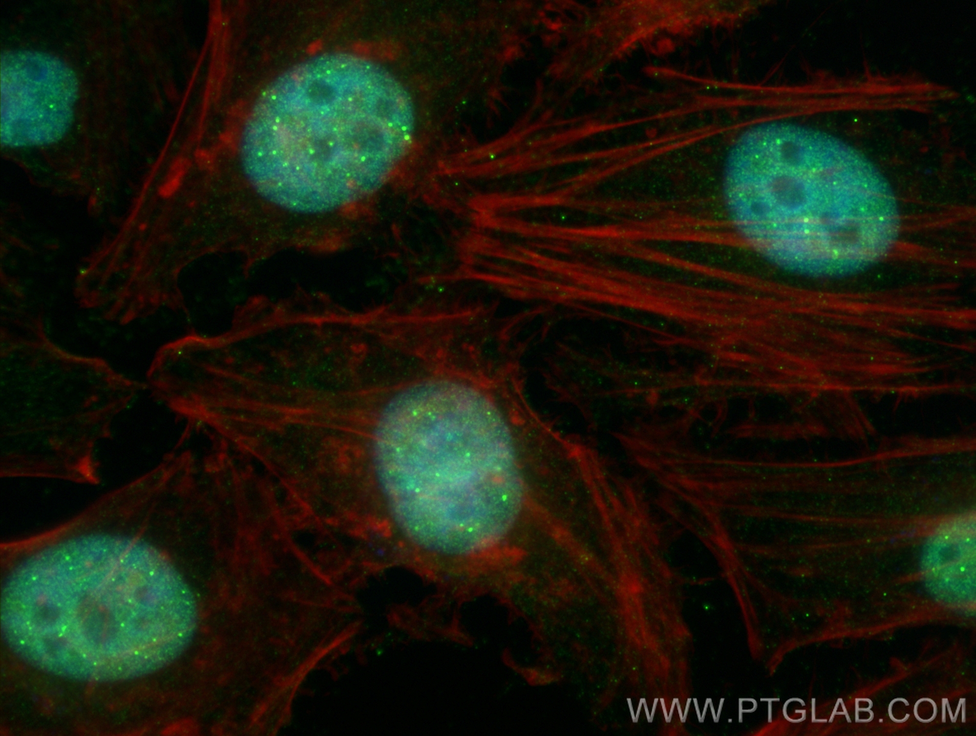 IF Staining of HeLa using 67154-1-Ig (same clone as 67154-1-PBS)