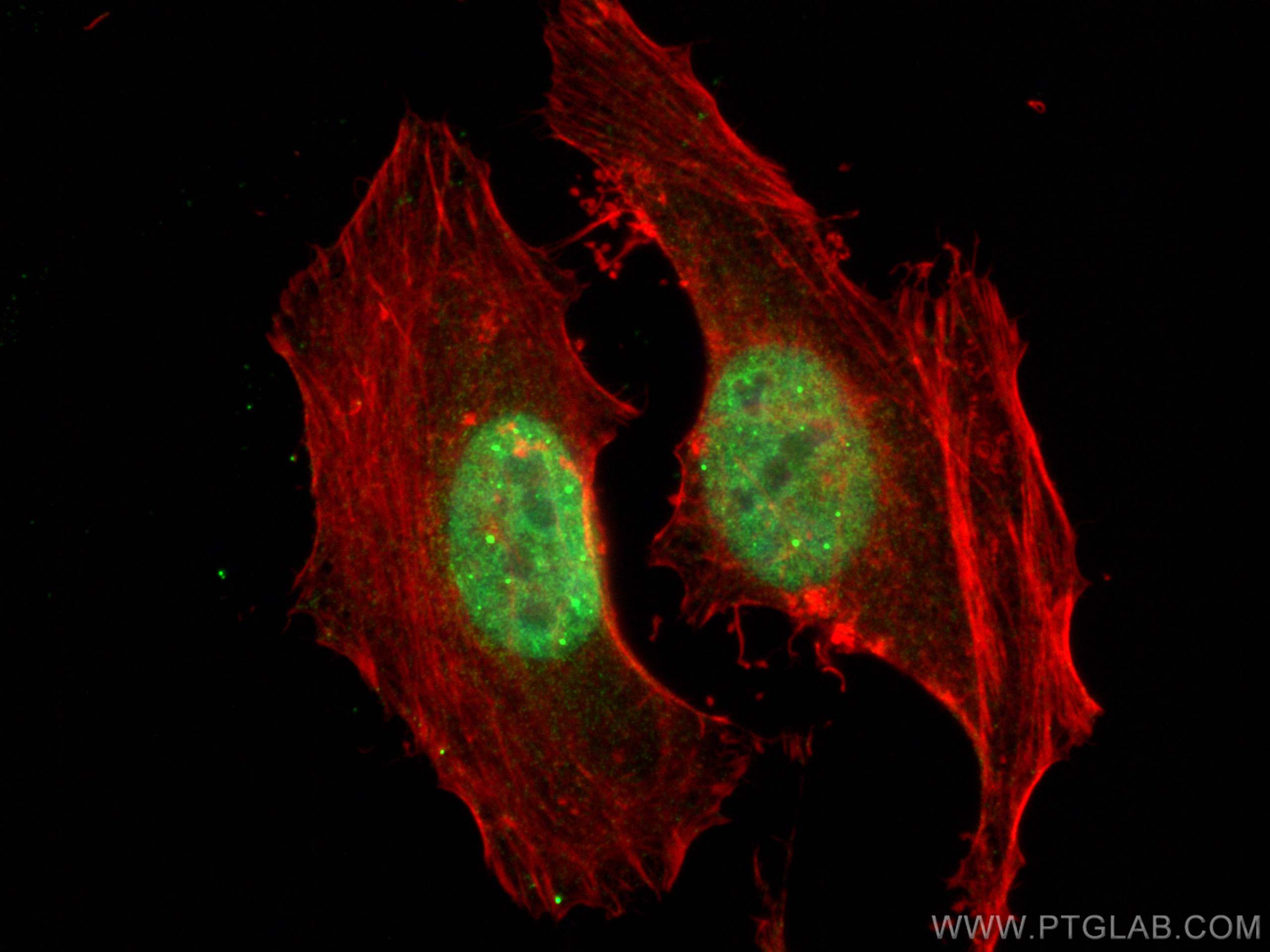 IF Staining of HeLa using 10947-1-AP