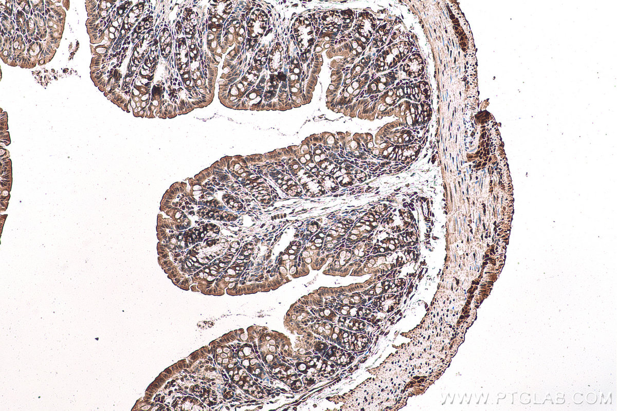 IHC staining of mouse colon using 11251-1-AP