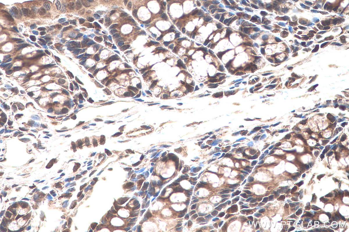 IHC staining of mouse colon using 11251-1-AP