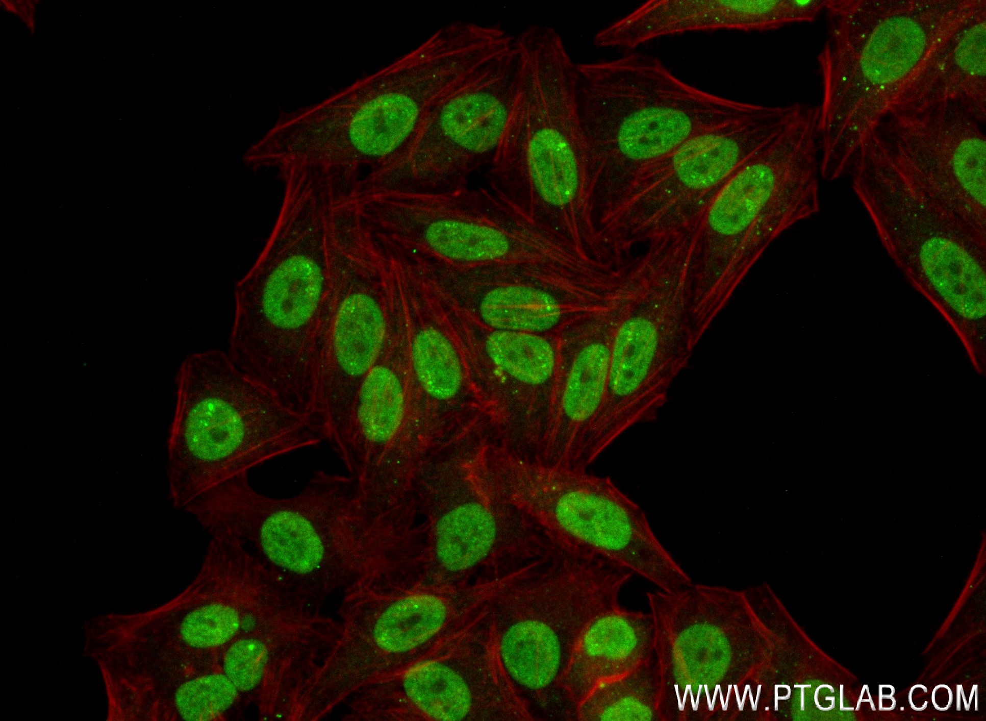 IF Staining of HepG2 using 84017-5-RR