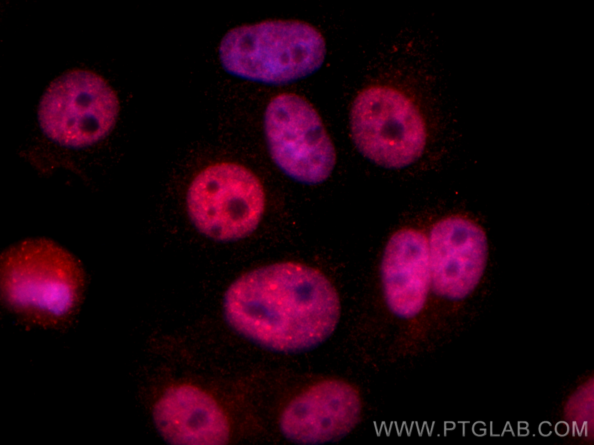 IF Staining of HepG2 using 84017-5-RR