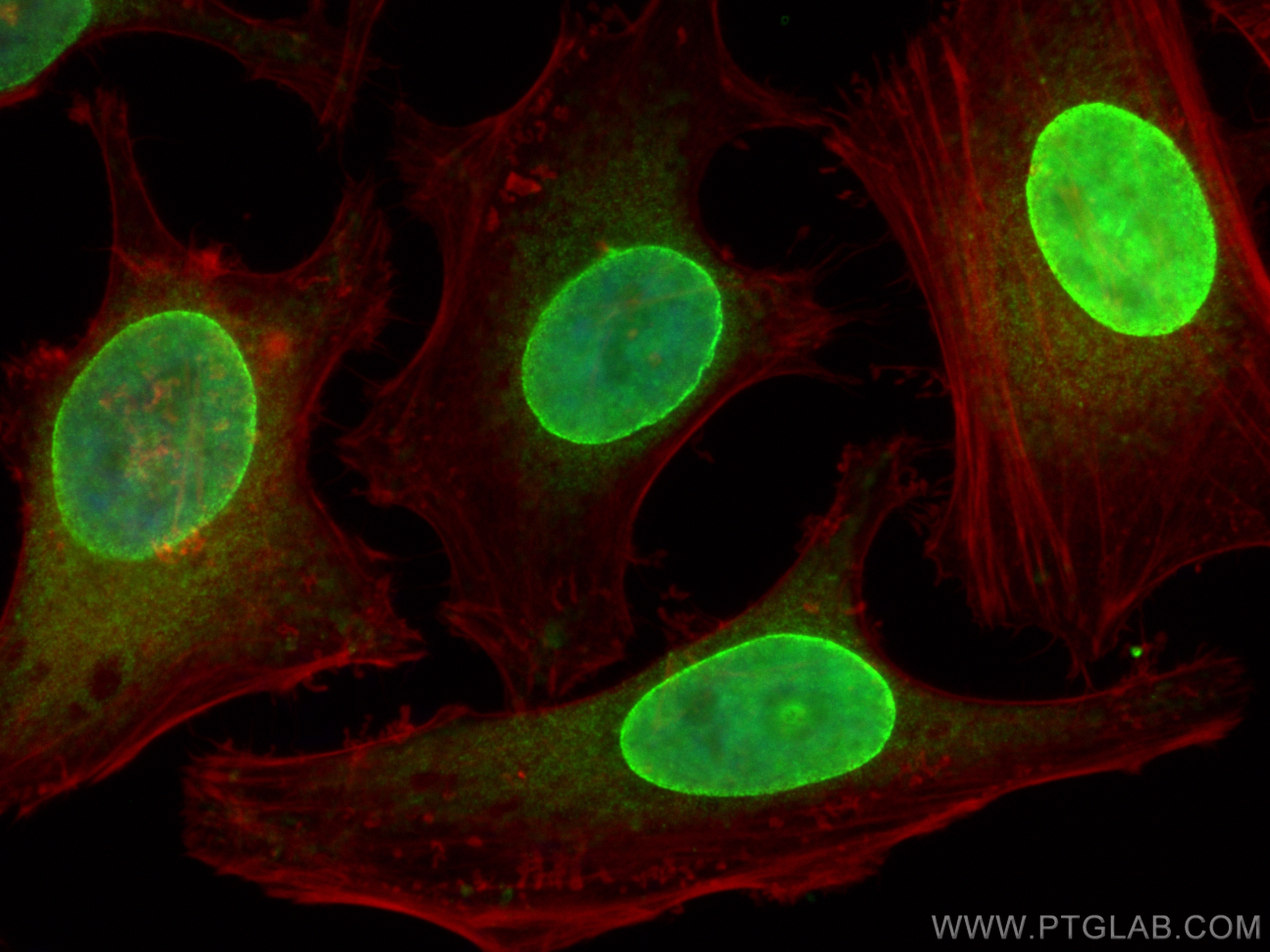 IF Staining of HeLa using 27556-1-AP