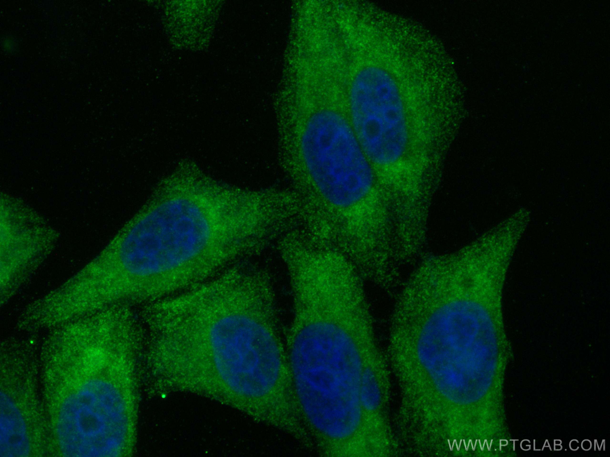 IF Staining of HepG2 using 26434-1-AP