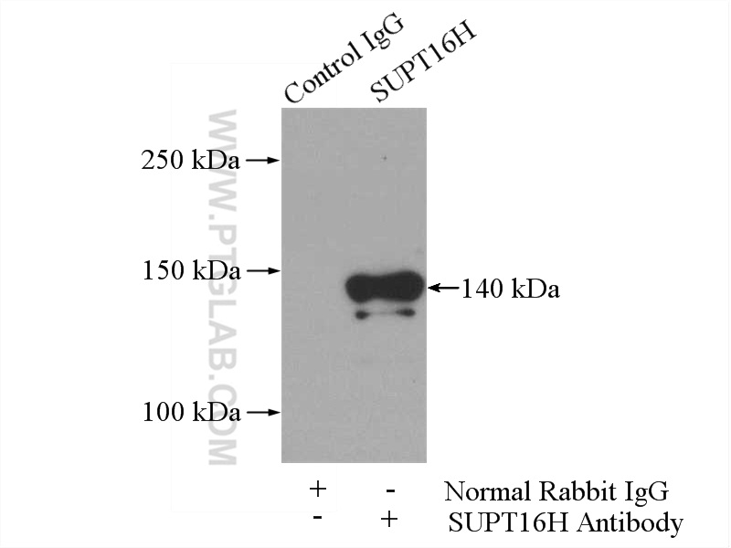 IP experiment of mouse brain using 20551-1-AP