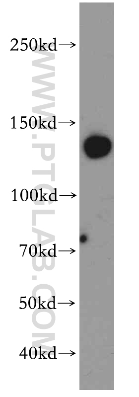 WB analysis of mouse brain using 20551-1-AP