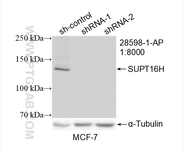 WB analysis of MCF-7 using 28598-1-AP