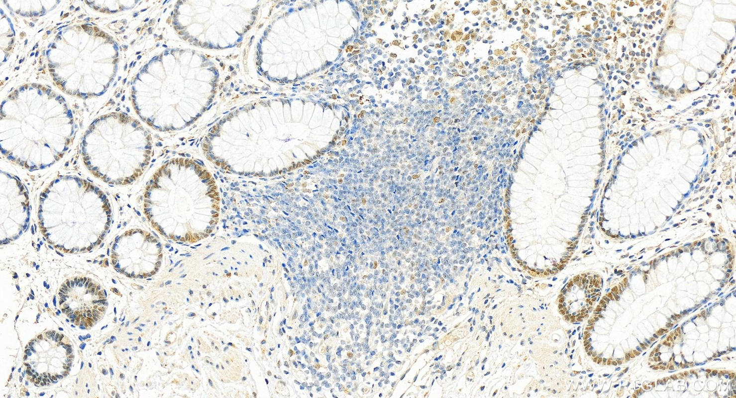 IHC staining of human colon using 68243-1-Ig (same clone as 68243-1-PBS)