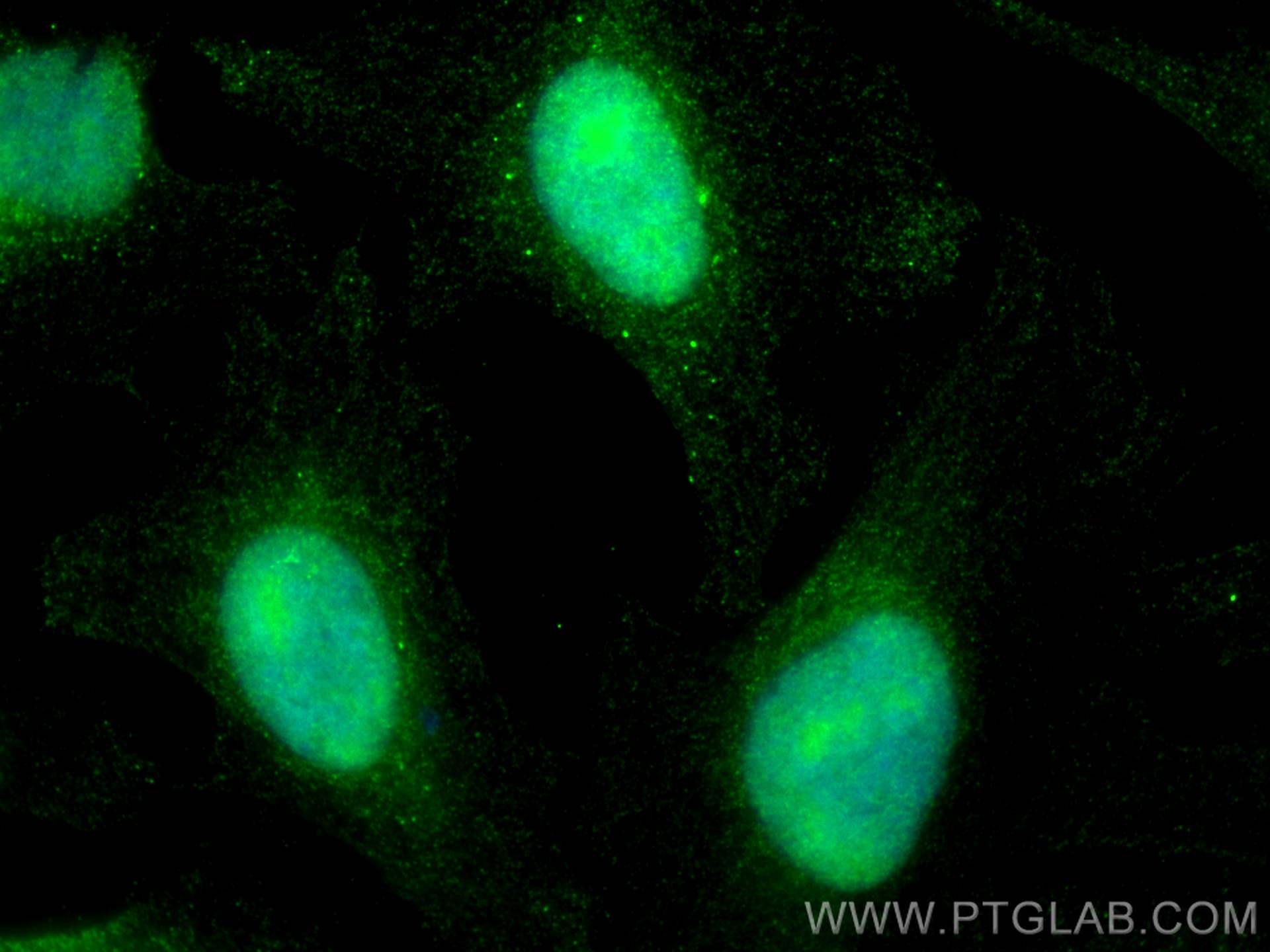 IF Staining of HeLa using 68243-1-Ig (same clone as 68243-1-PBS)