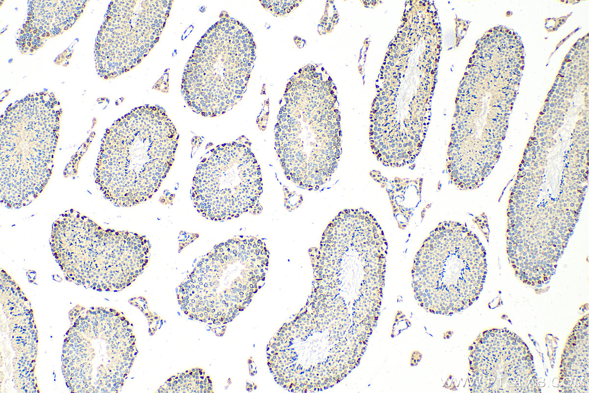 IHC staining of mouse testis using 16511-1-AP