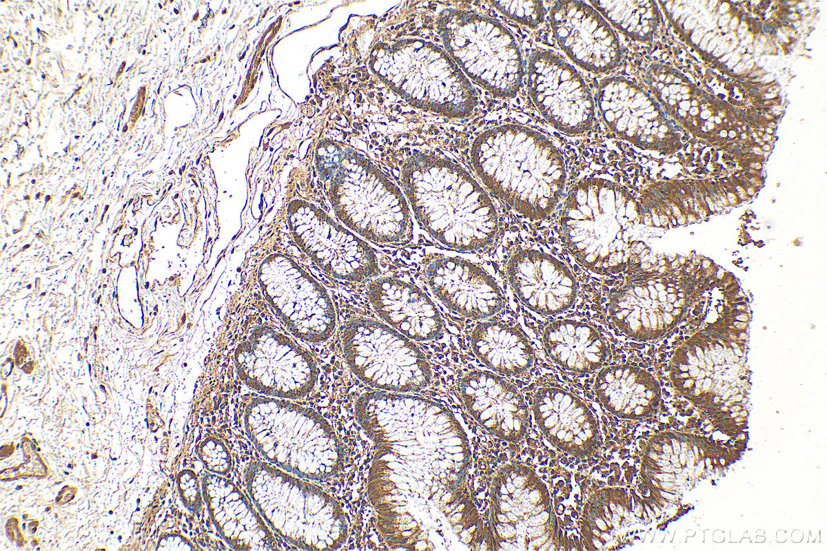 IHC staining of human colon using 15379-1-AP