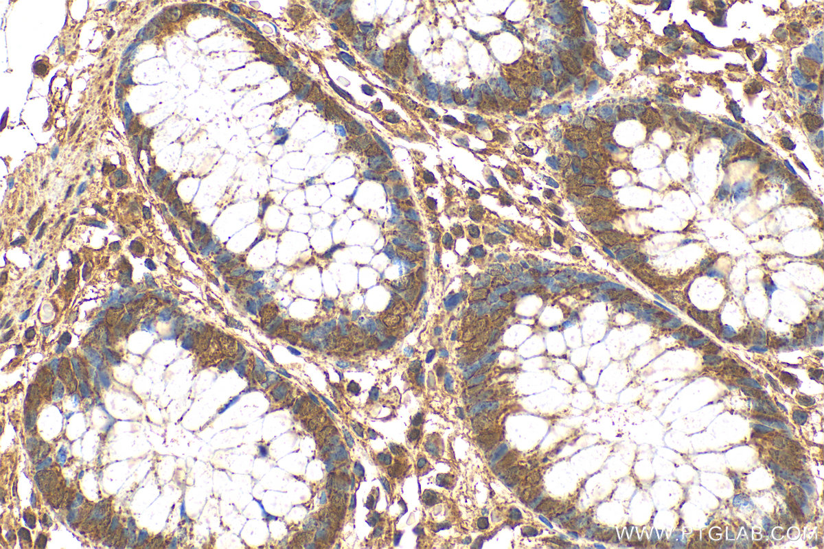 IHC staining of human colon using 15379-1-AP