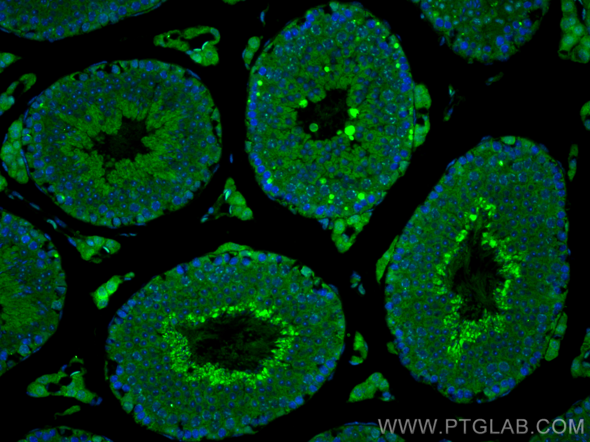 IF Staining of mouse testis using 10508-1-AP