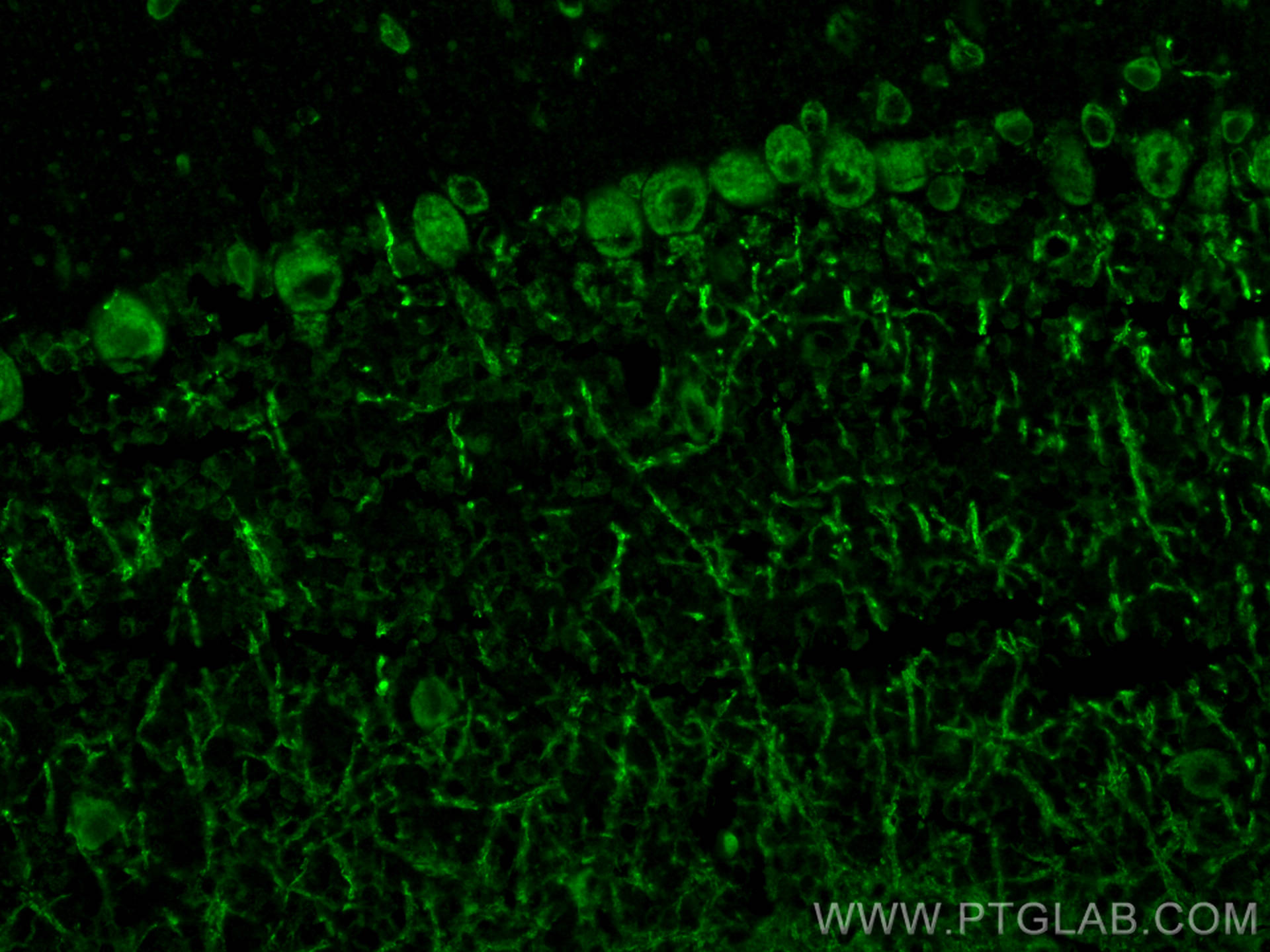 IF Staining of mouse cerebellum using 26829-1-AP