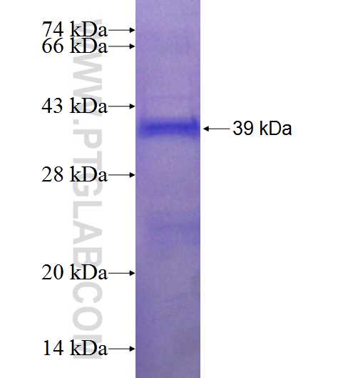 SUV39H1 fusion protein Ag21190 SDS-PAGE