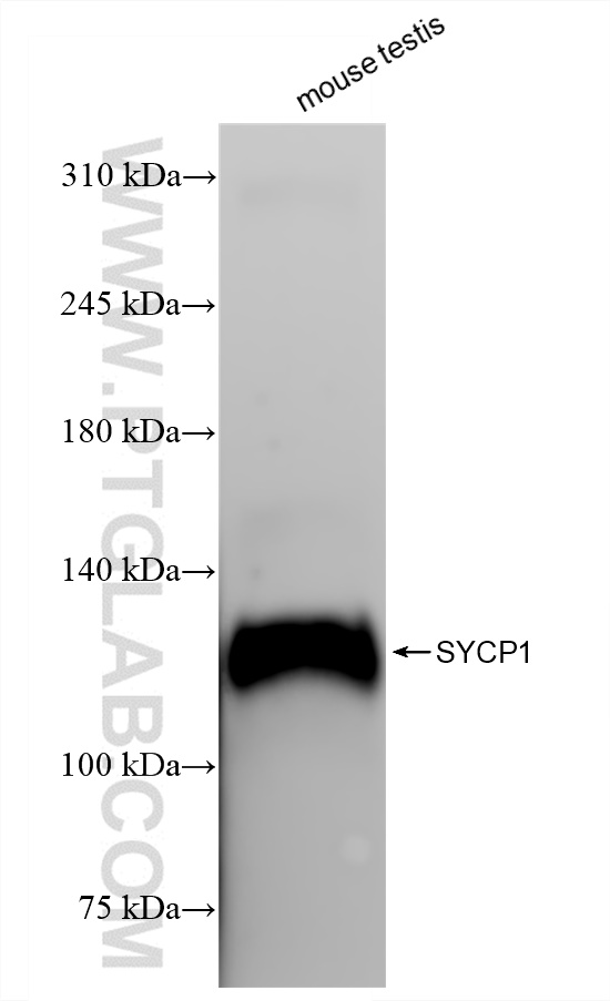 WB analysis of mouse testis using 83382-1-RR