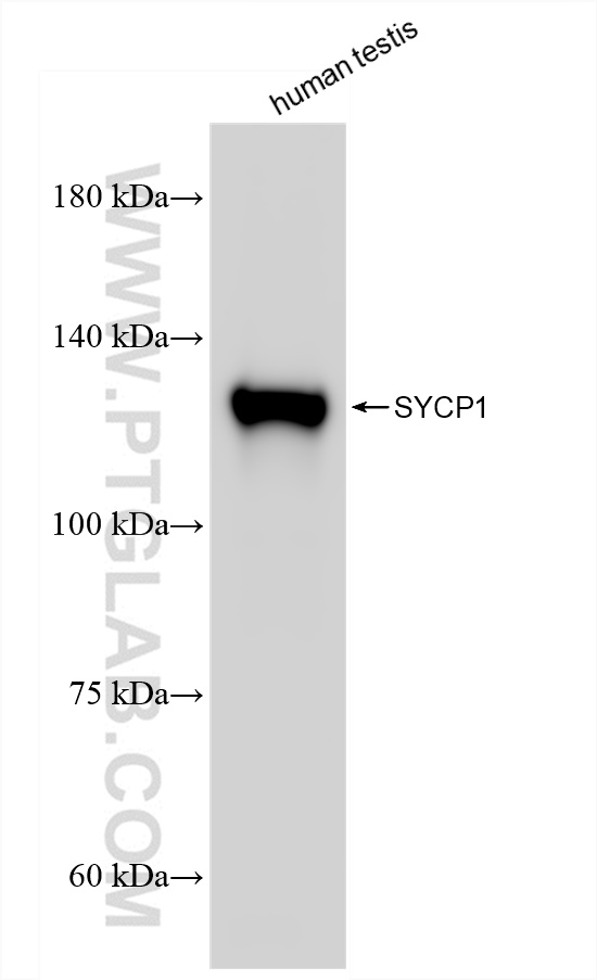 WB analysis of human testis using 83382-2-RR