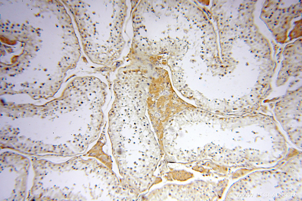 IHC staining of human testis using 11519-1-AP