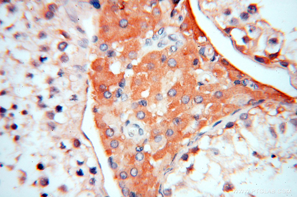 IHC staining of human testis using 11519-1-AP