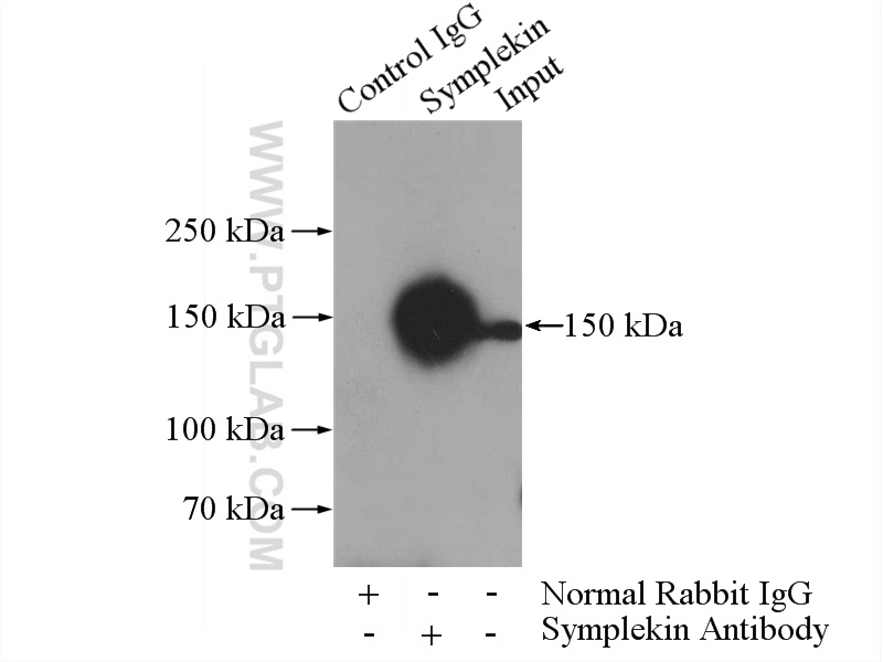 IP experiment of K-562 using 11519-1-AP