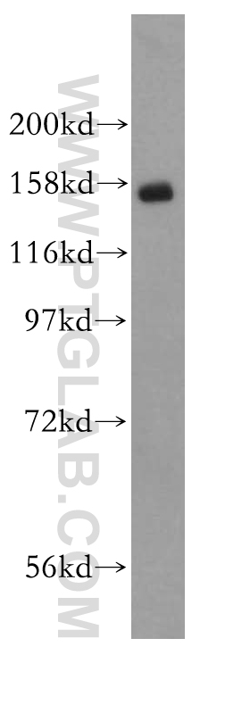 WB analysis of K-562 using 11519-1-AP