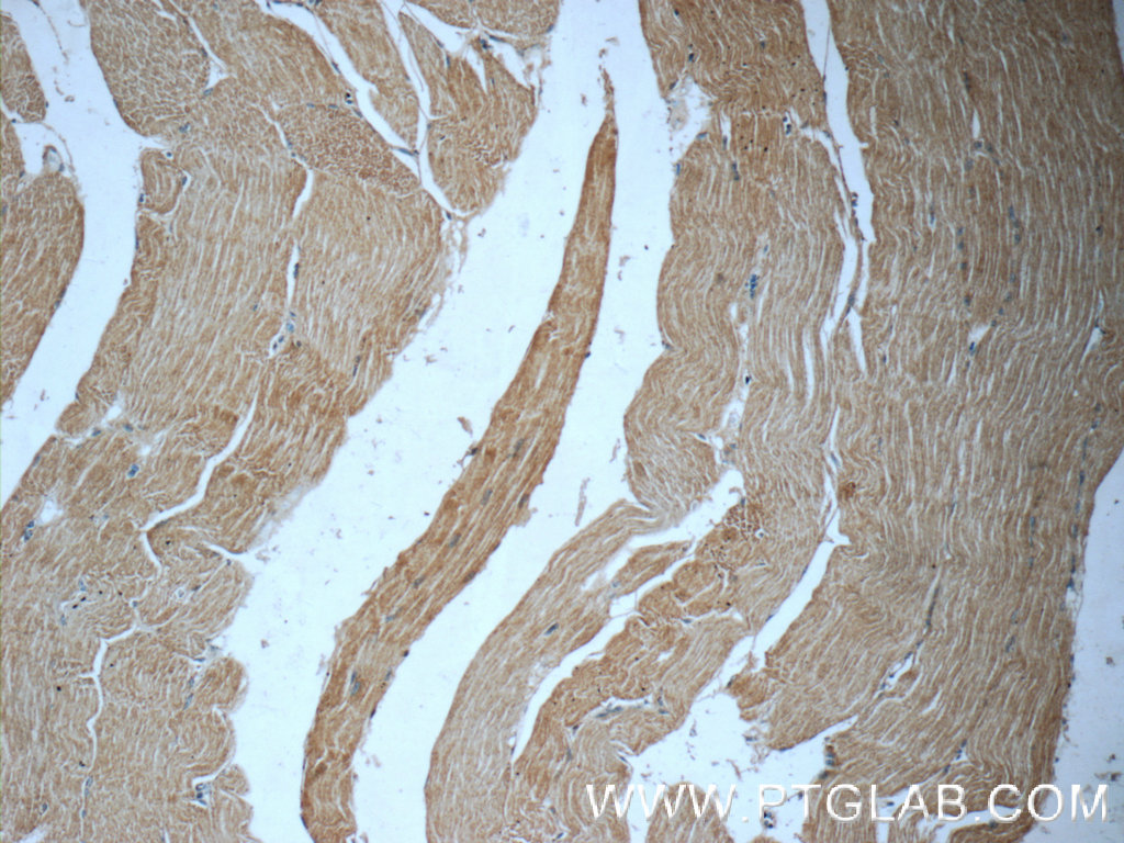 IHC staining of human skeletal muscle using 25151-1-AP