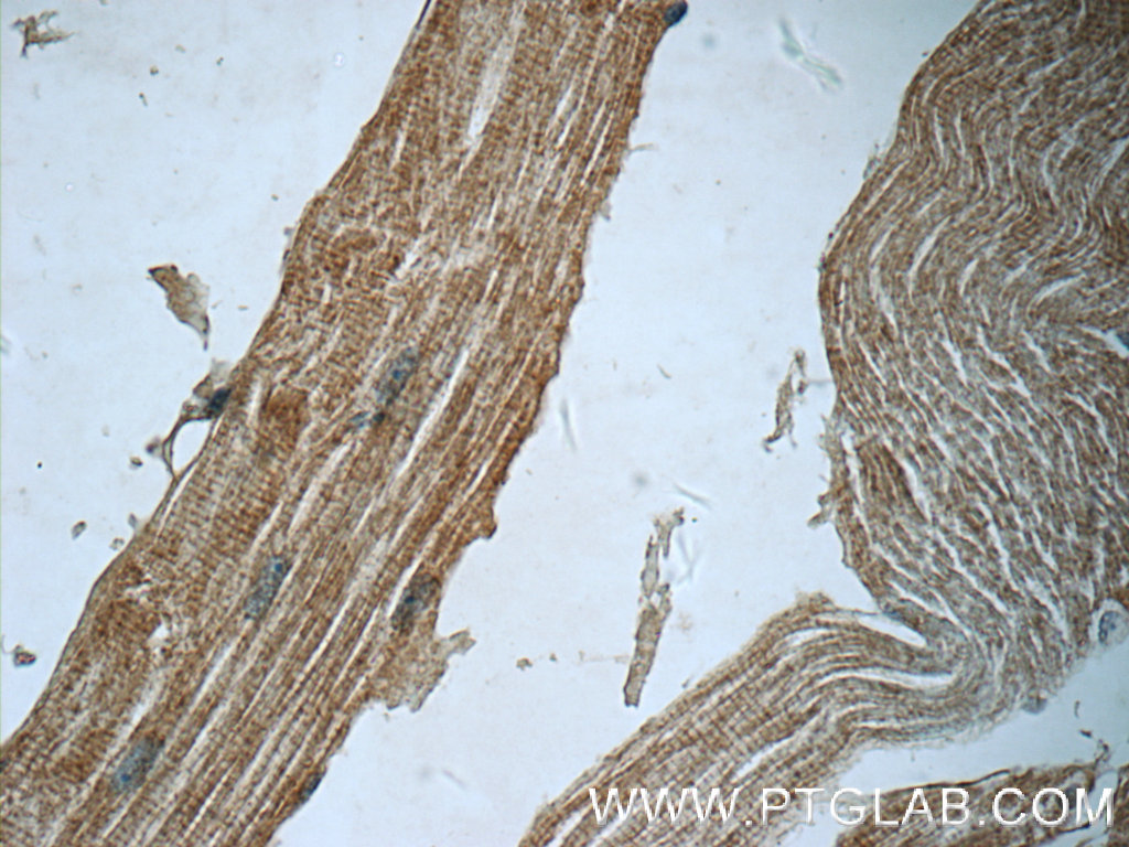 IHC staining of human skeletal muscle using 25151-1-AP