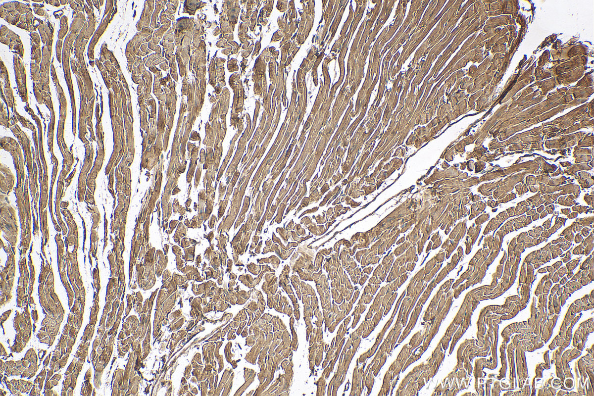 IHC staining of mouse heart using 25151-1-AP