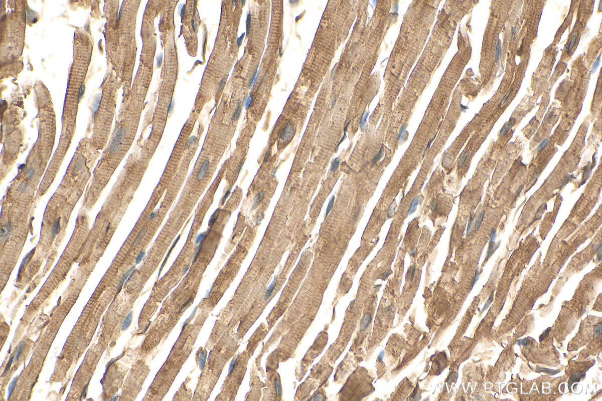 IHC staining of mouse heart using 25151-1-AP