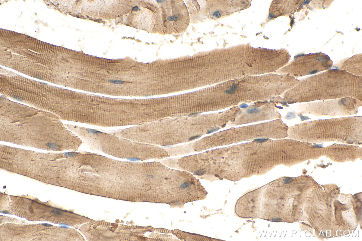 IHC staining of mouse skeletal muscle using 25151-1-AP