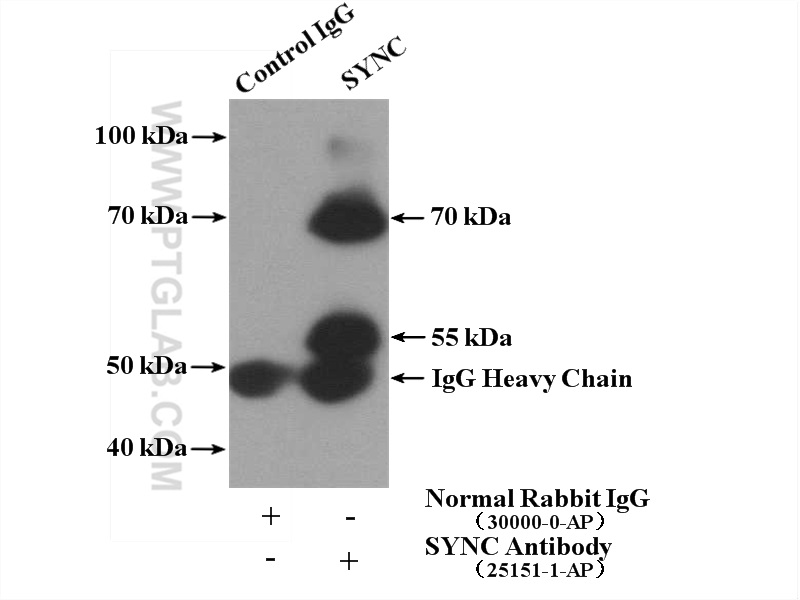 IP experiment of mouse heart using 25151-1-AP