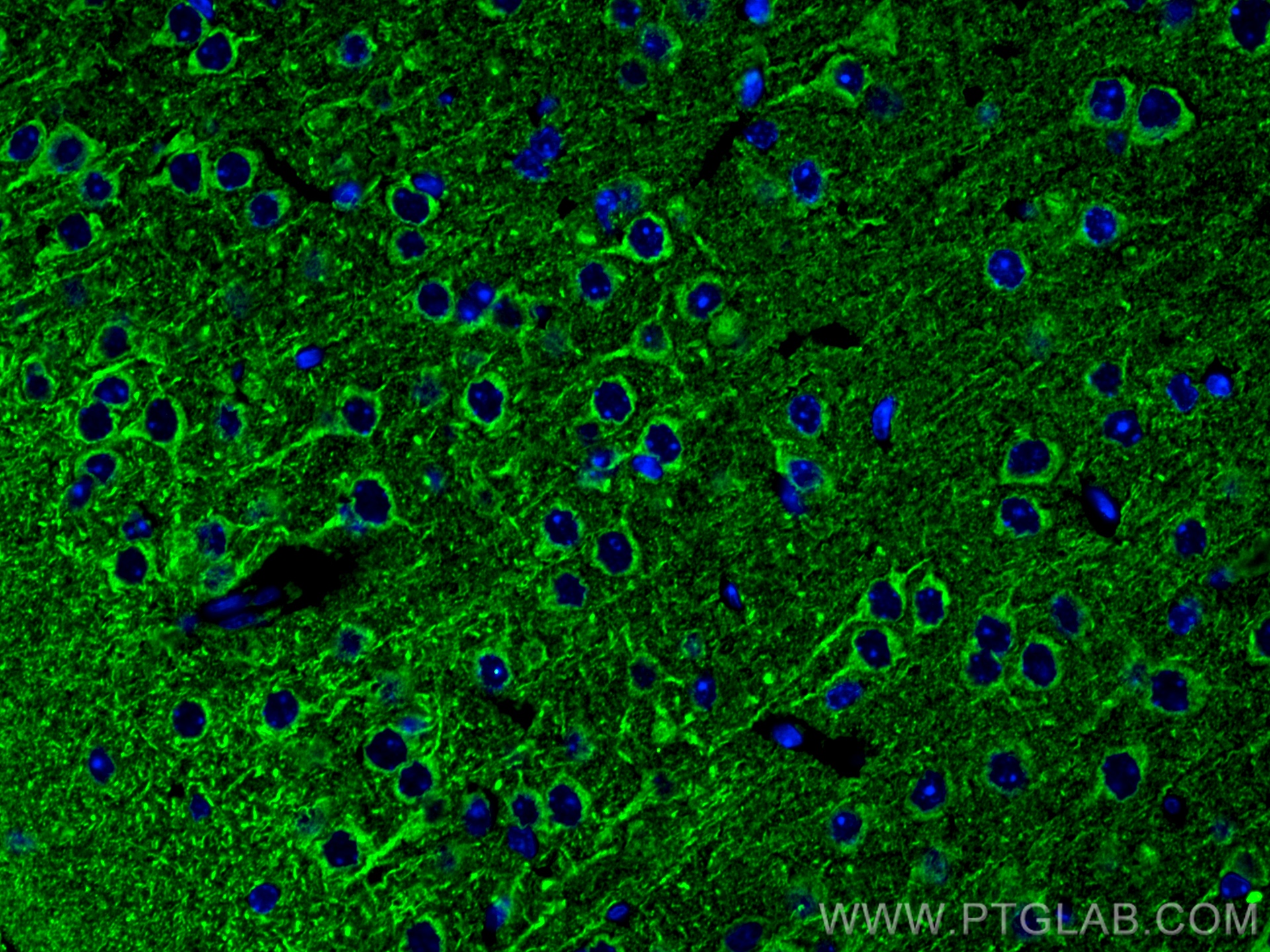 IF Staining of mouse brain using 25265-1-AP