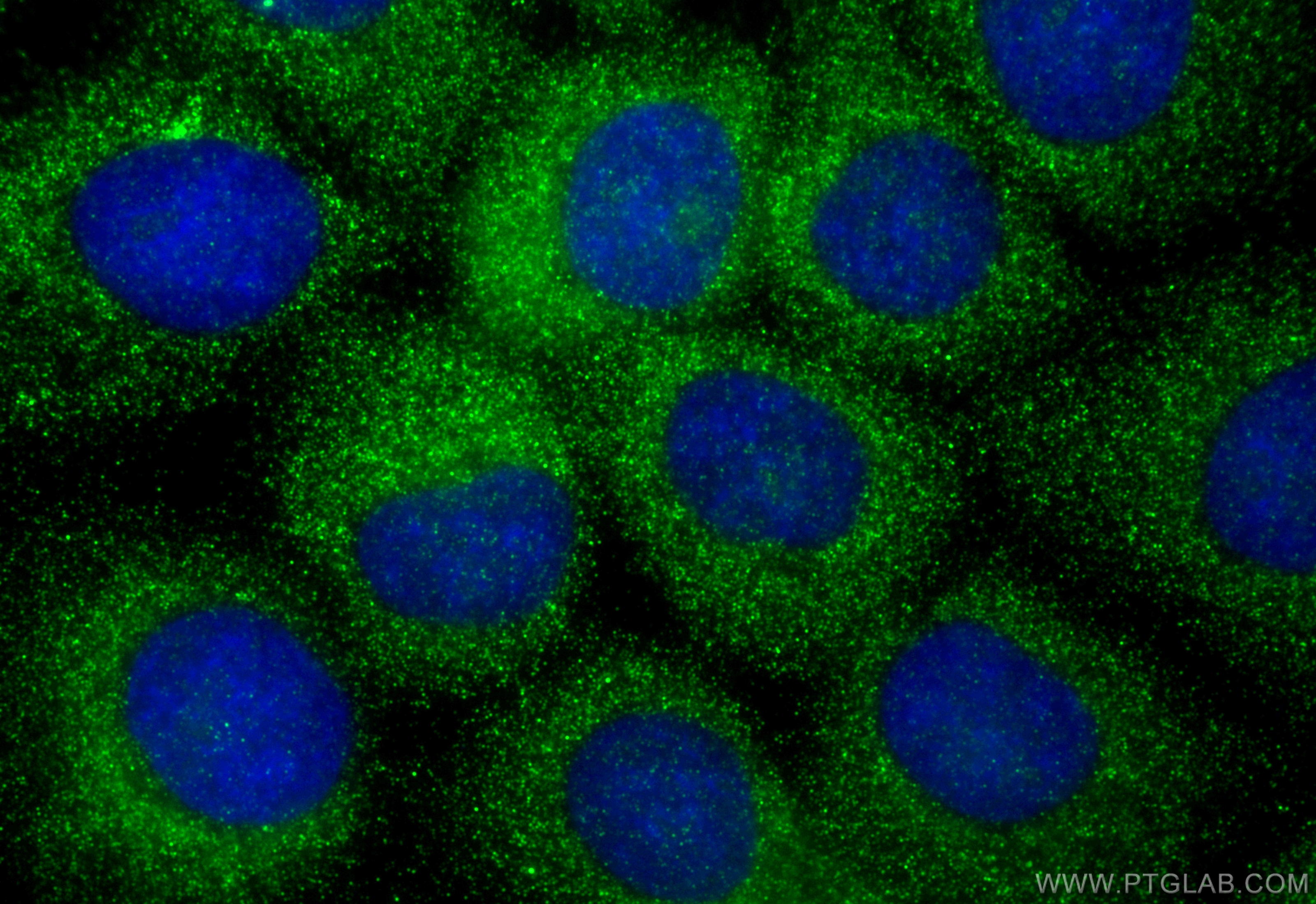 IF Staining of A431 using 10432-1-AP