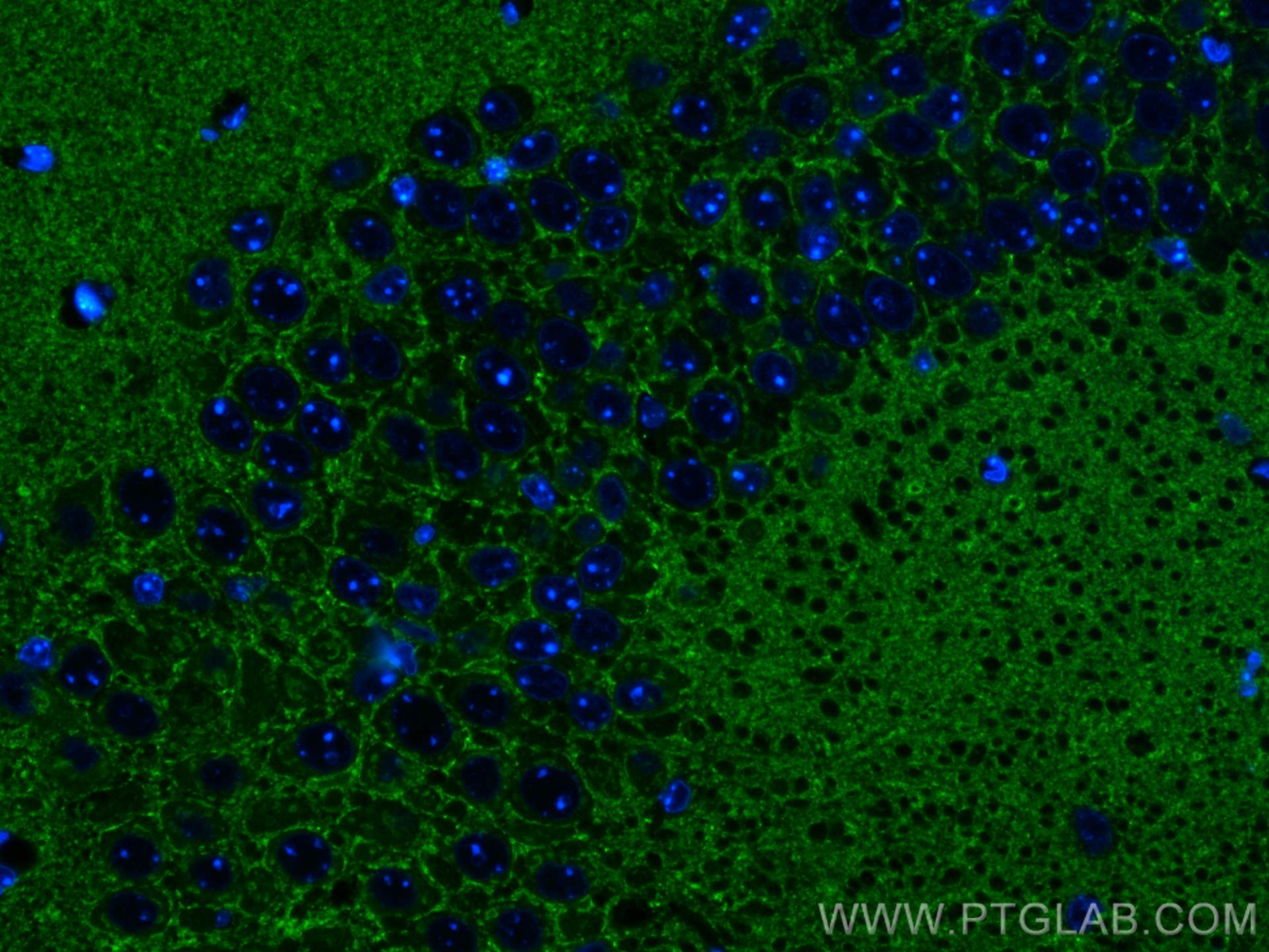 IF Staining of mouse brain using 68176-1-Ig (same clone as 68176-1-PBS)