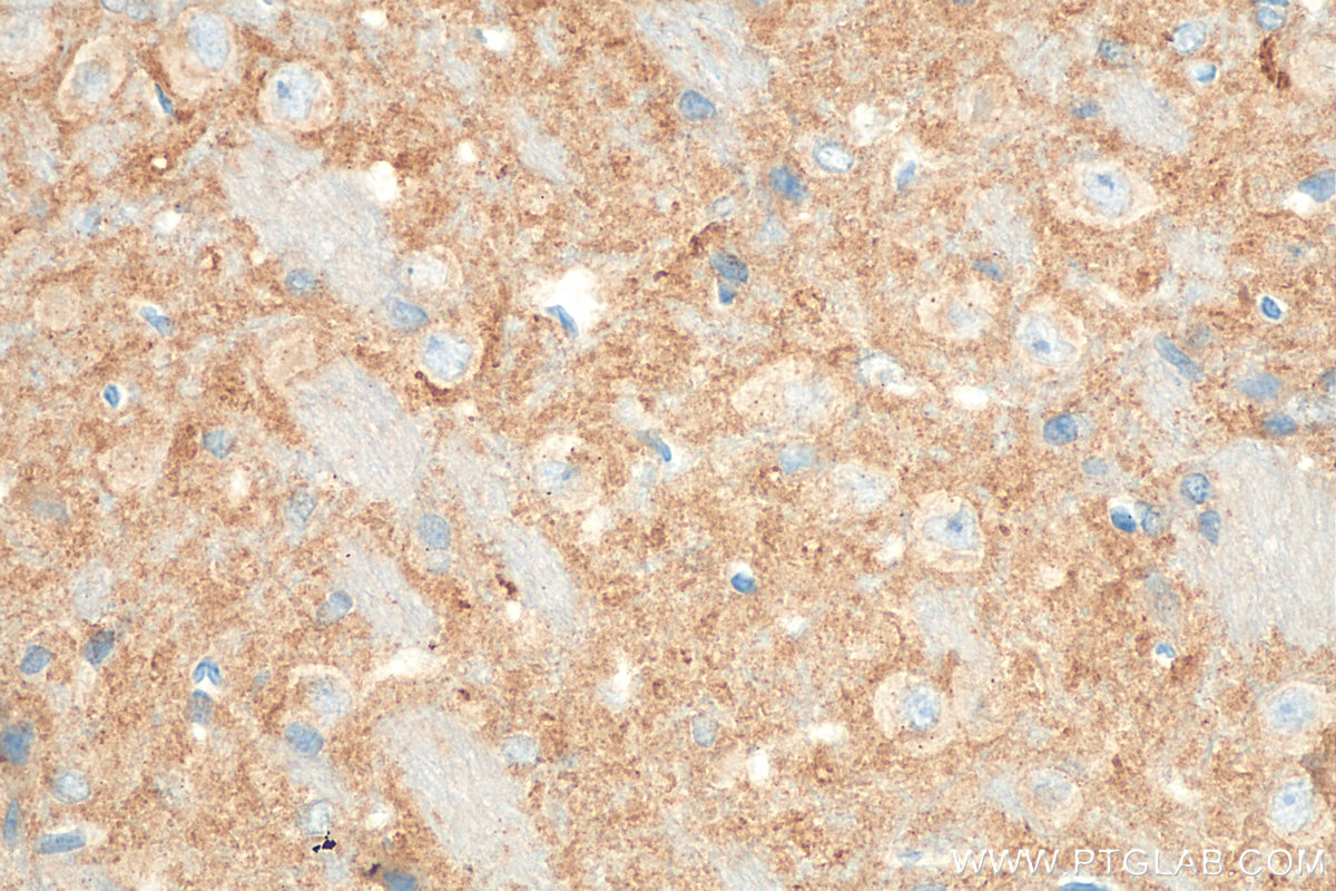 IHC staining of rat brain using 68176-1-Ig (same clone as 68176-1-PBS)