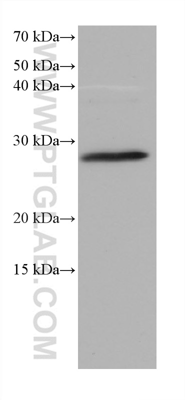 WB analysis of mouse retina using 68176-1-Ig (same clone as 68176-1-PBS)