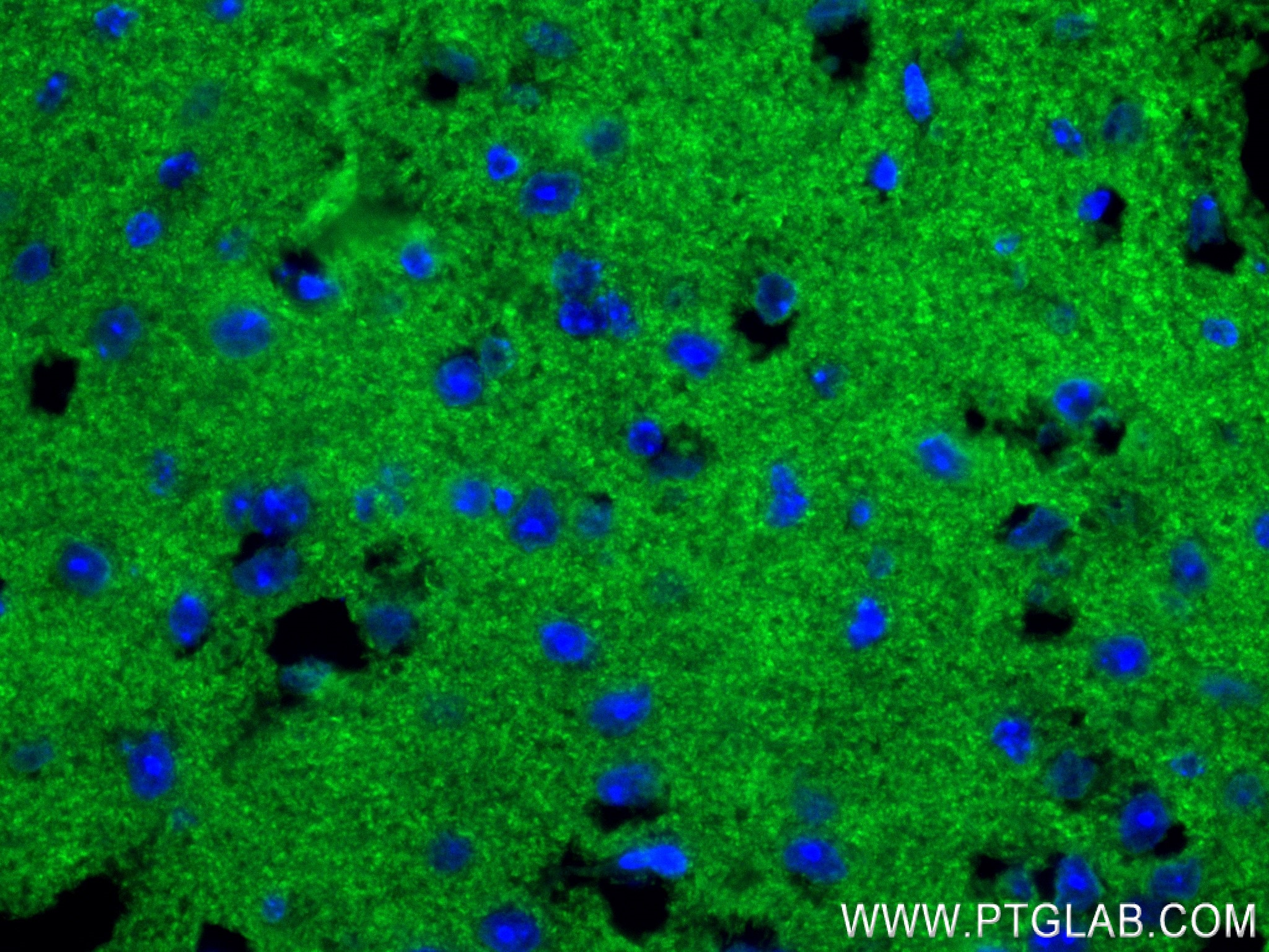 IF Staining of mouse brain using 84161-3-RR (same clone as 84161-3-PBS)