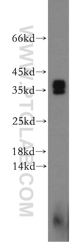 WB analysis of human brain using 21751-1-AP