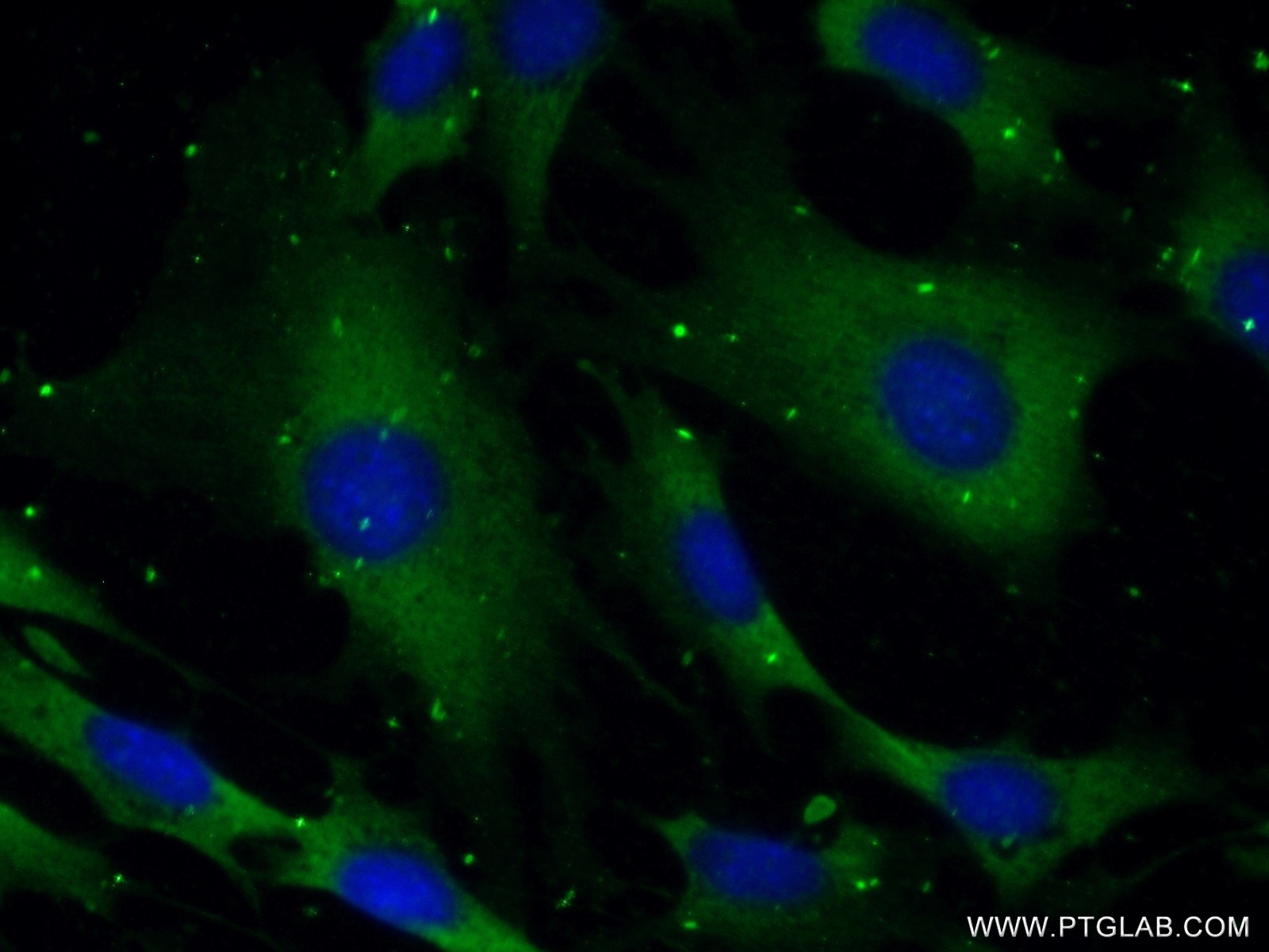 IF Staining of NIH/3T3 using 24677-1-AP