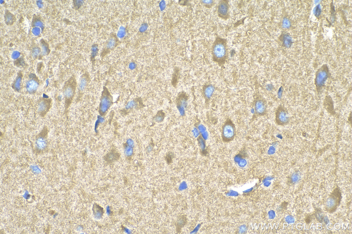 IHC staining of rat brain using 24677-1-AP