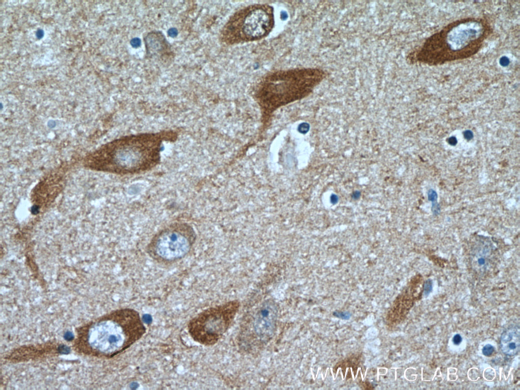 IHC staining of human brain using 24677-1-AP