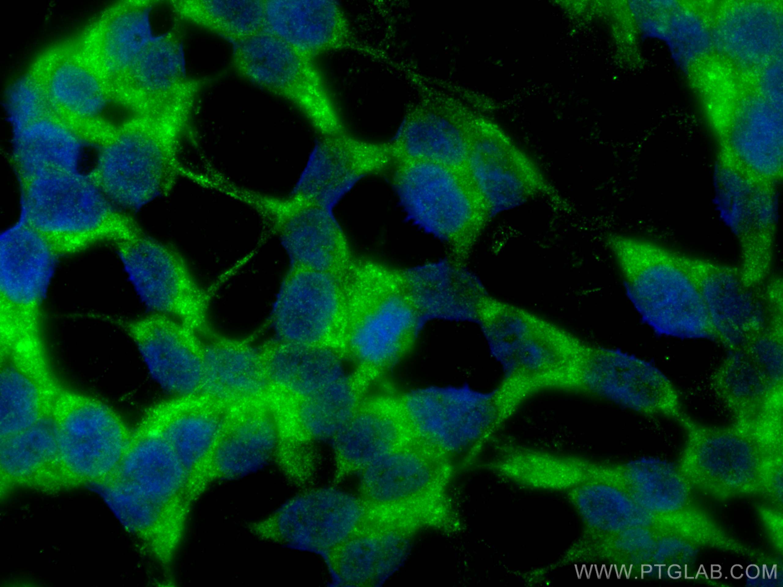 IF Staining of SH-SY5Y using 13893-1-AP