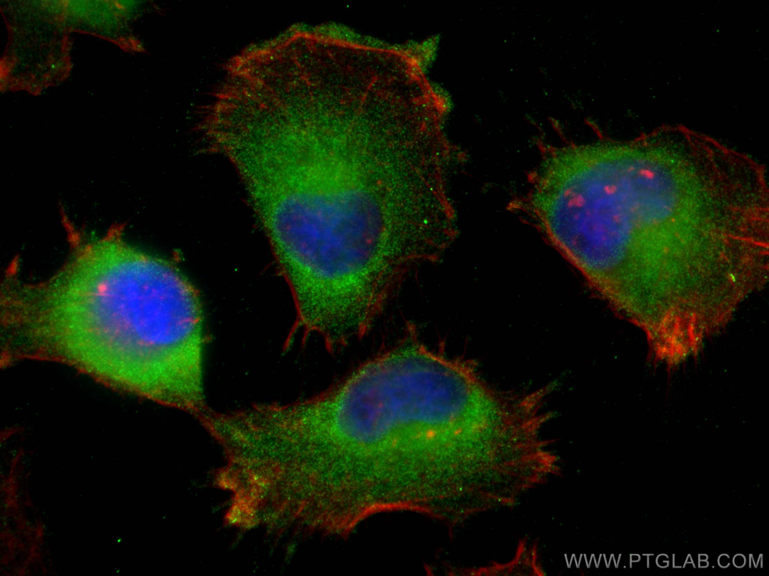 IF Staining of U-251 using 30391-1-AP