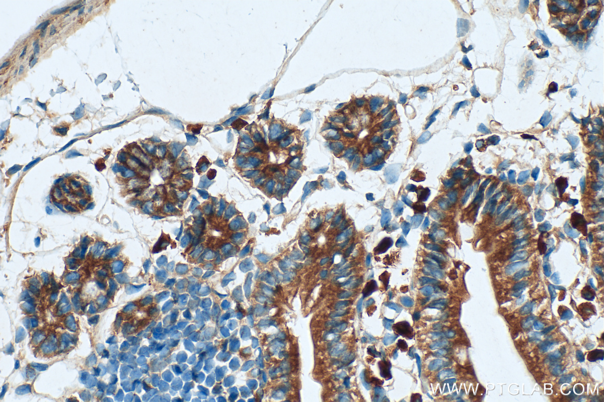 IHC staining of mouse small intestine using 30391-1-AP