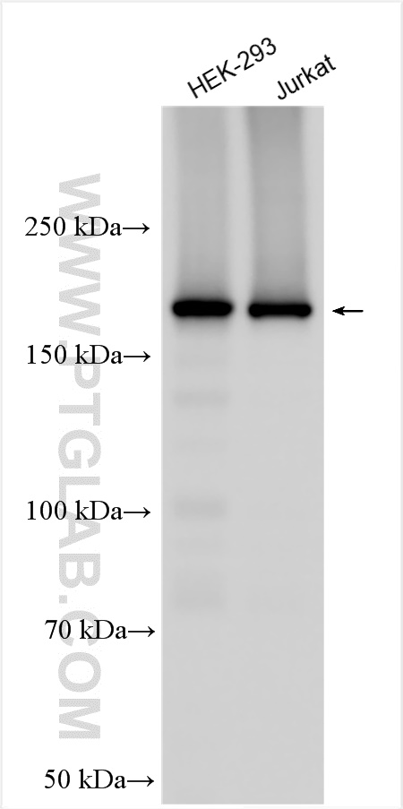 WB analysis using 30391-1-AP