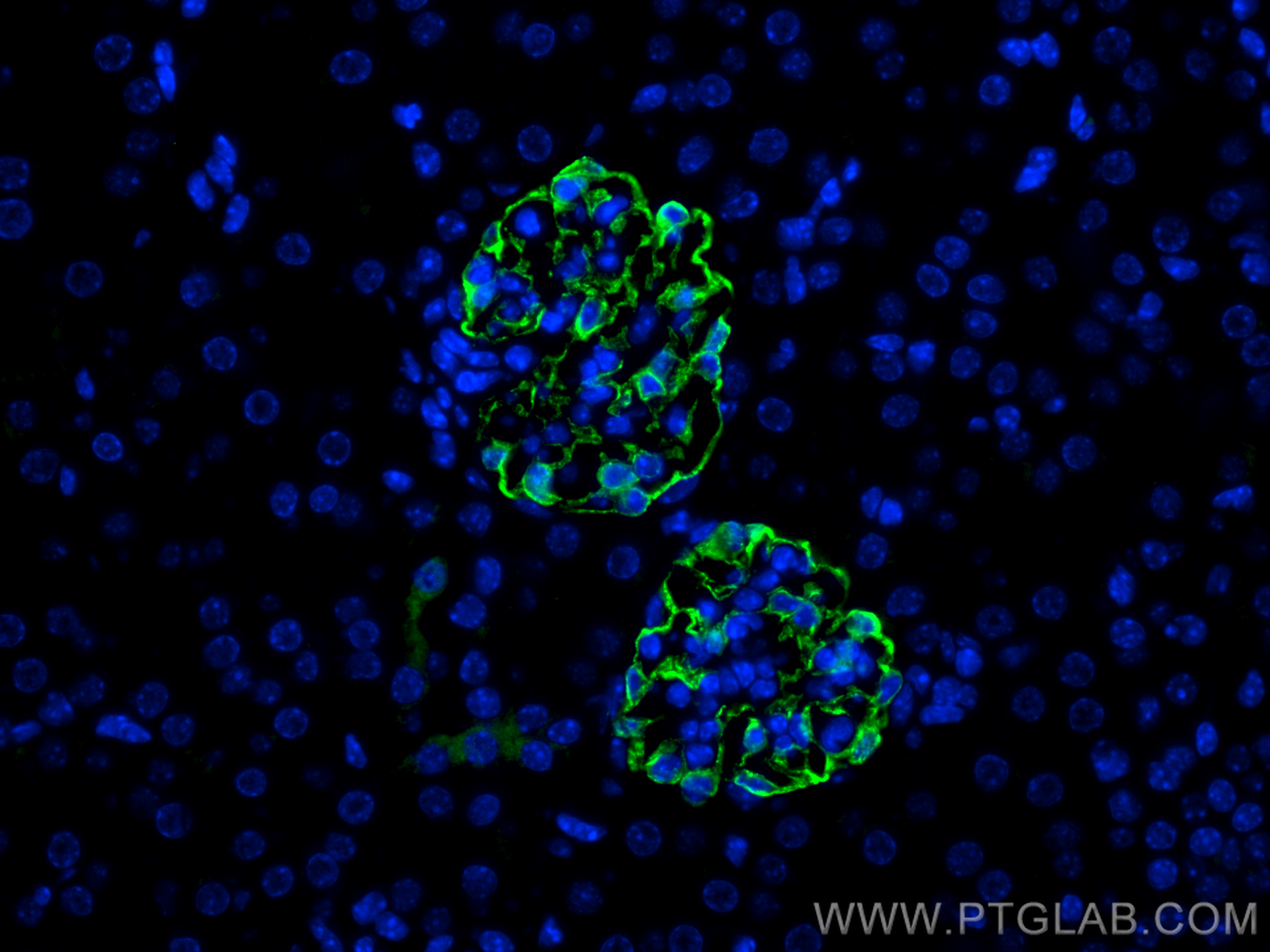 IF Staining of mouse kidney using 21064-1-AP