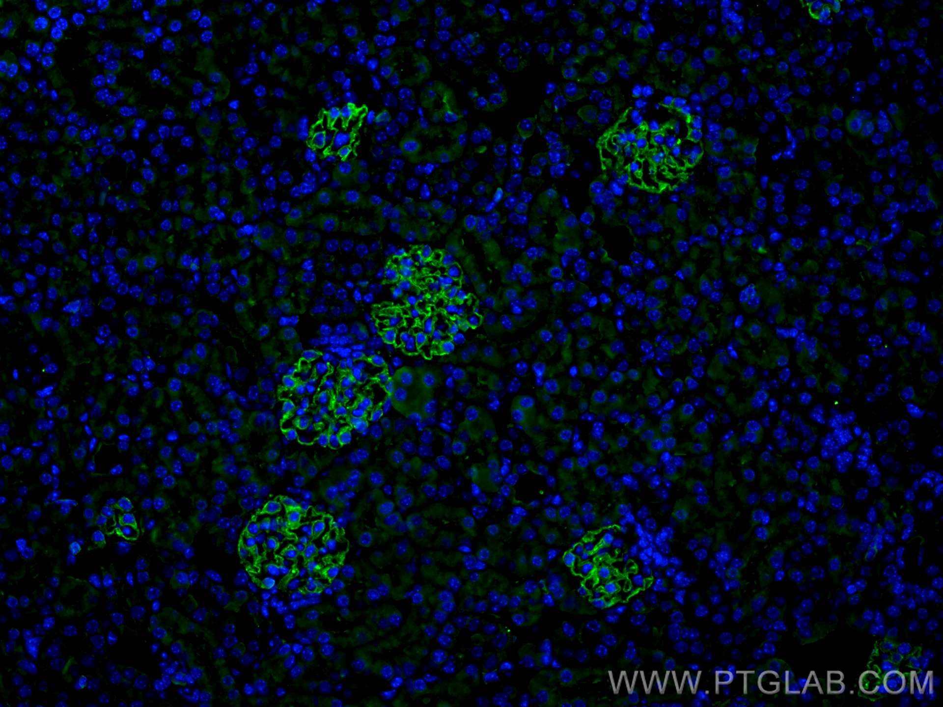 IF Staining of mouse kidney using 67339-1-Ig